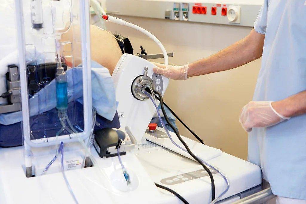 Como ultrassom inaugura nova era de tratamento de câncer sem cirurgias – 19/10/2025 – Equilíbrio e Saúde