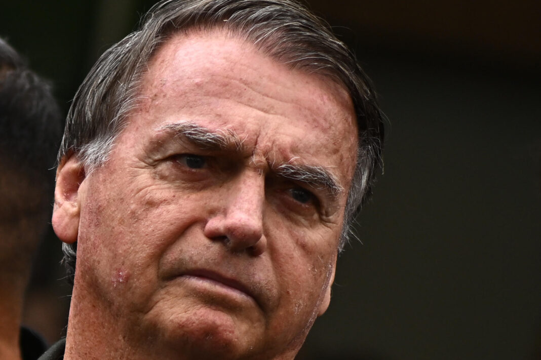 Bolsonaro vai precisar de internamento hospitalar para cirurgia