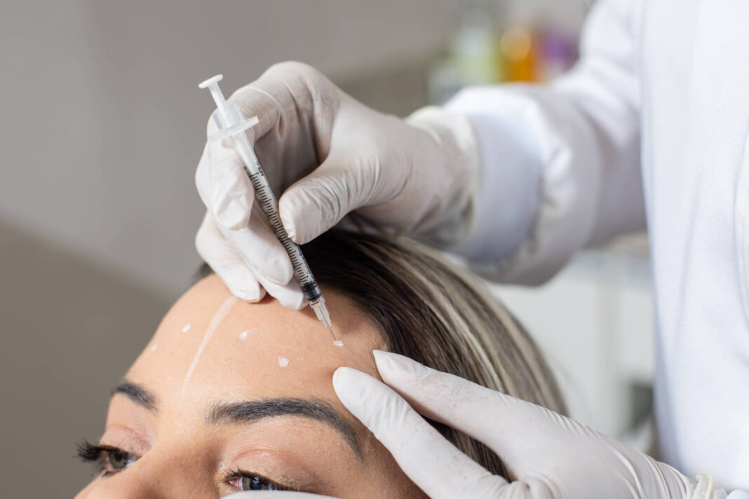 Ozempic pode reduzir duração do botox, diz estudo – 13/11/2025 – Equilíbrio