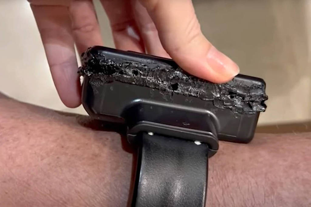 Mercado de tornozeleiras eletrônicas deve dobrar até 2030 – 25/11/2025 – Mercado