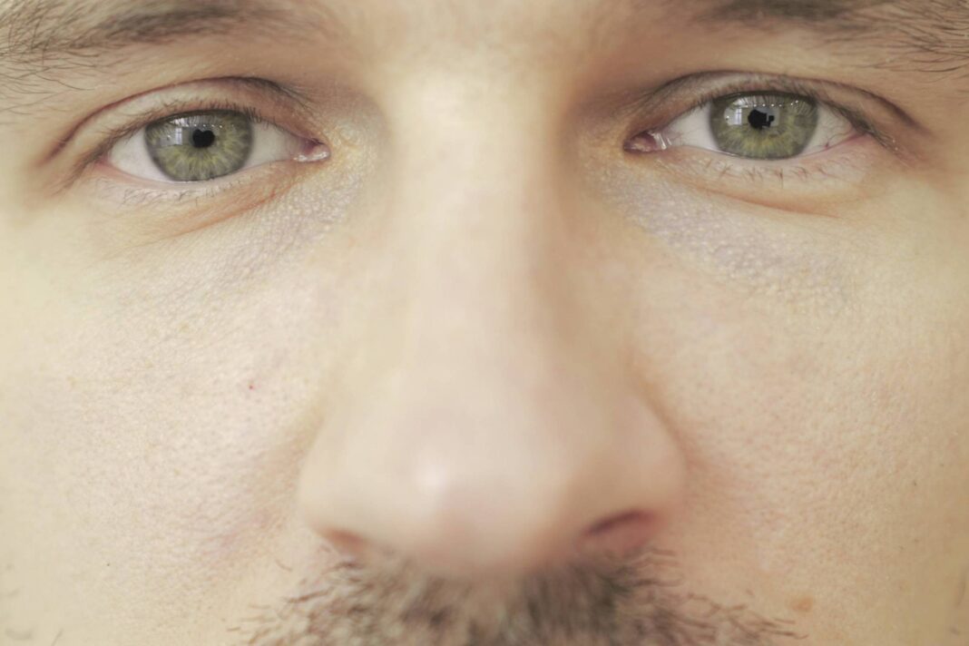 ‘Trend’ de raspar os cílios pode causar lesões nos olhos – 02/12/2025 – Equilíbrio