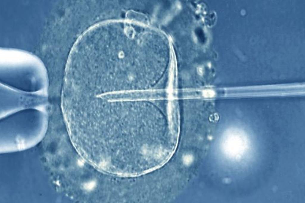 IA contribui para maior precisão da reprodução assistida – 22/12/2025 – Equilíbrio e Saúde