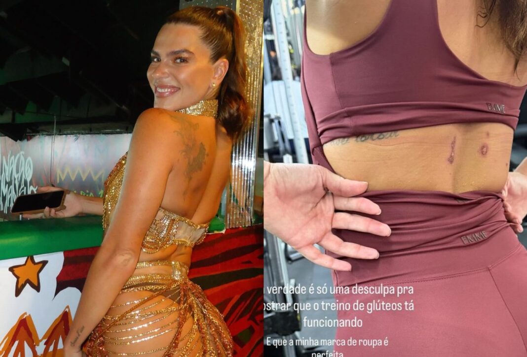 Mariana Goldfarb mostra machucados após ensaio na quadra da Grande Rio