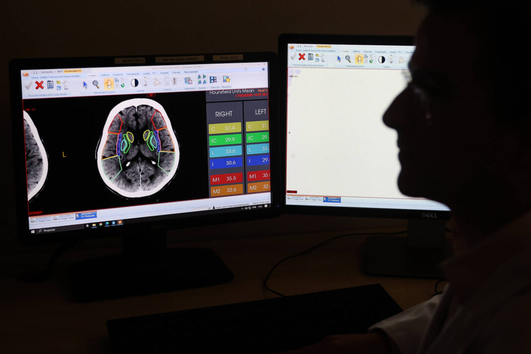 IA pode detectar risco de 130 doenças enquanto você dorme – 10/01/2026 – Equilíbrio e Saúde