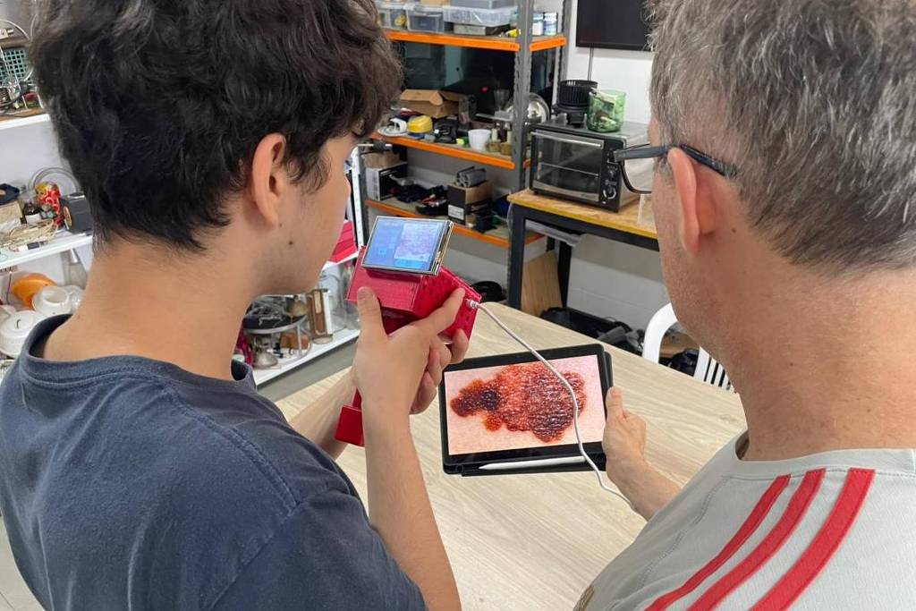 RS: Estudantes criam tecnologia que detecta câncer de pele – 15/01/2026 – Equilíbrio e Saúde