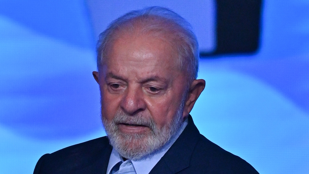 Lula passa por cirurgia de catarata “sem intercorrências”