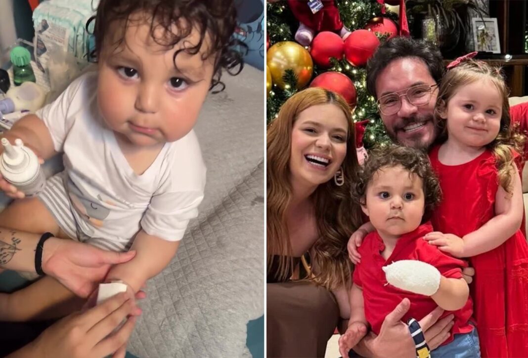 Viih Tube mostra evolução de mão de Ravi após queimaduras graves em acidente