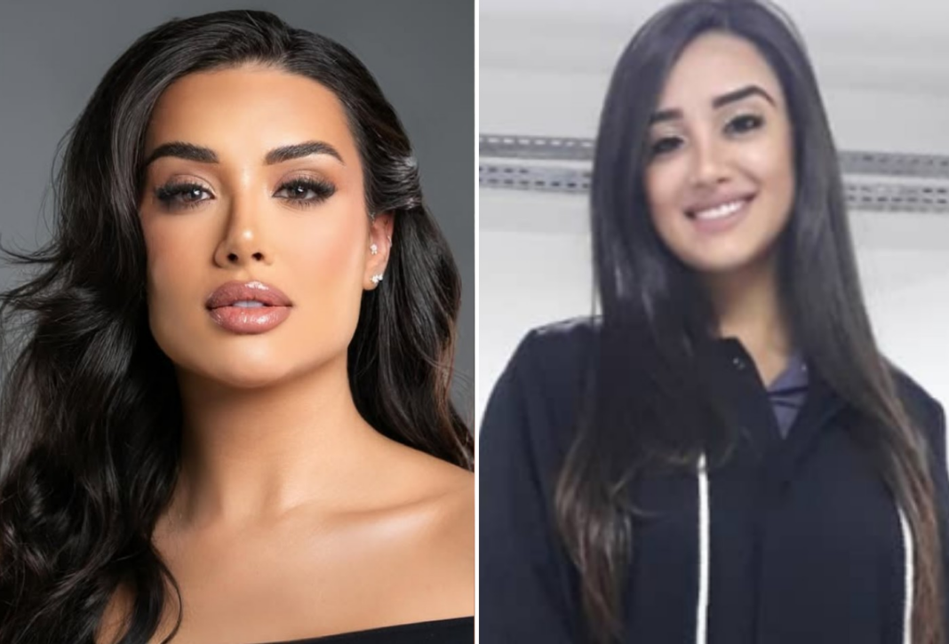 BBB 26: Jordana investe mais de R$ 40 mil em procedimentos antes do reality; veja