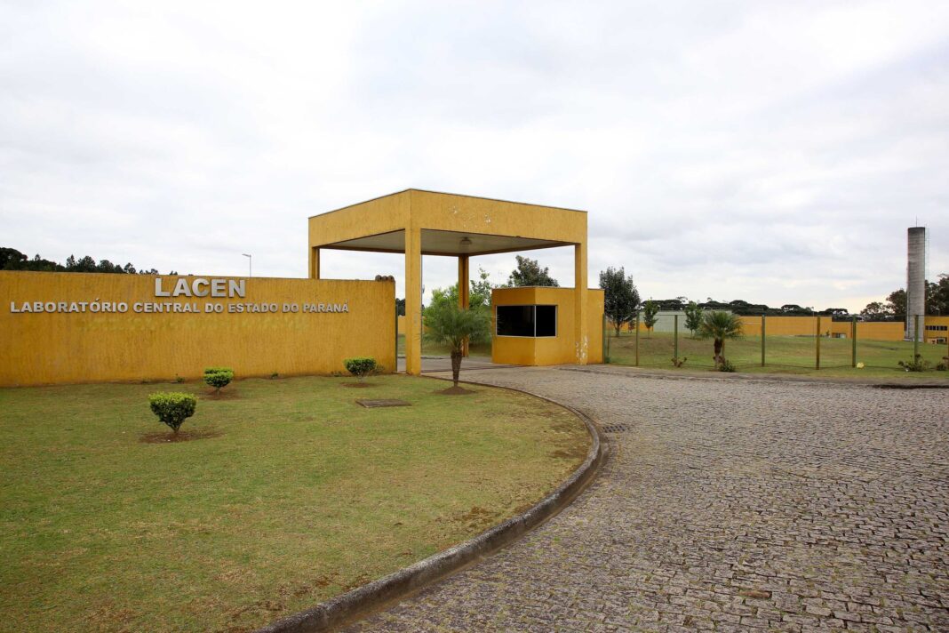 Diagnóstico da tuberculose ganha agilidade no Paraná