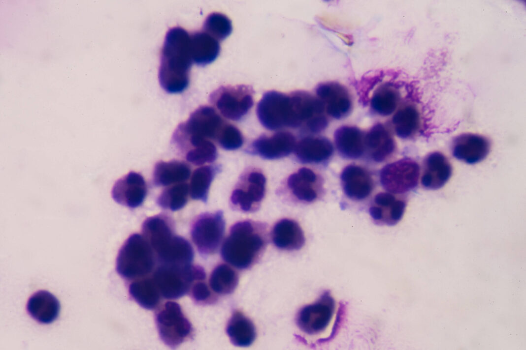 Como bioeletricidade pode abrir novas vias contra o câncer – 08/03/2026 – Marcelo Leite