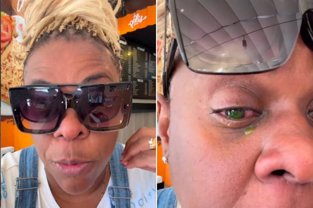 Cacau Protásio relata perda de visão após reação a pomada – 25/03/2026 – Celebridades