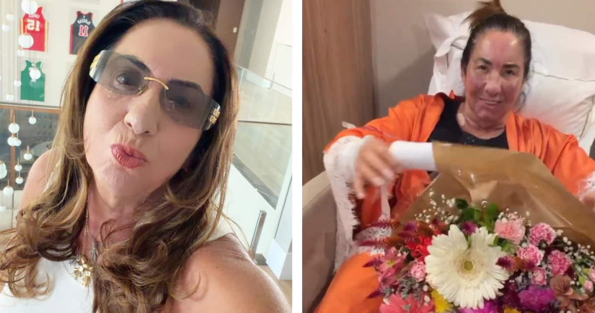 Mãe de Virginia faz procedimentos estéticos e é lembrada por Zé Felipe